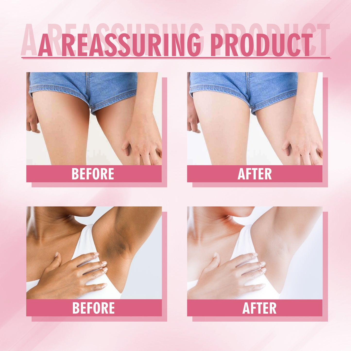 OUHOE Brightening Body Cream - For Elbows, Knees & Underarms, Evens Skin Tone, Moisturizes Dry Areas