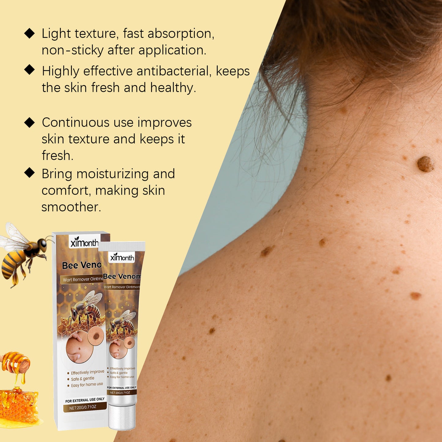 XIMONTH Bee Venom Wart Removal Cream - Natural Wart Treatment with Honey & Mugwort Root | Fast Acting, Skin-Friendly Formula