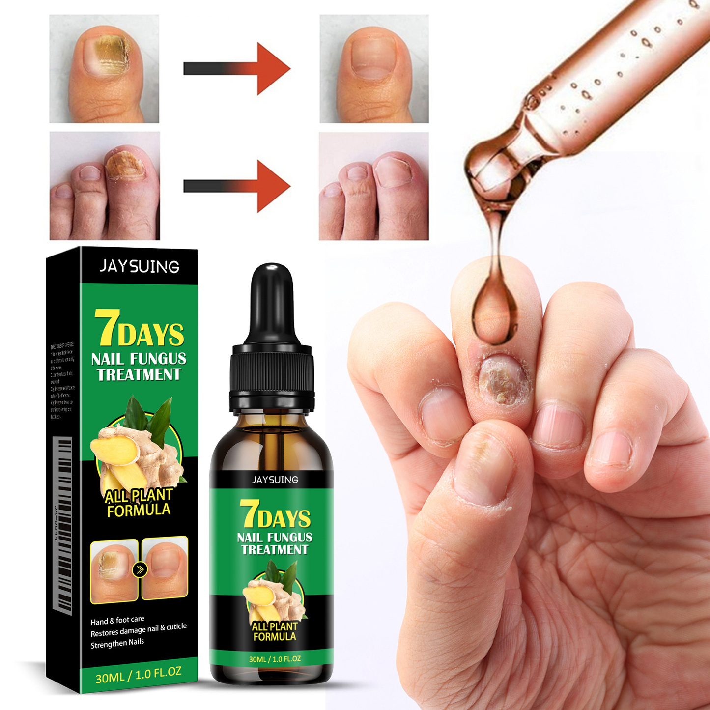 Jaysuing Nail & Cuticle Conditioning Serum - with Ginger Extract, Helps Nails Appear Smoother & Stronger, Nourishing Care