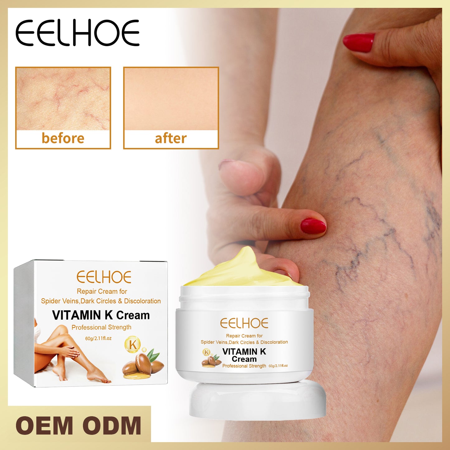EELHOE Vitamin K Soothing Body Cream