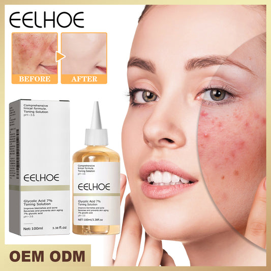 EELHOE 7% Glycolic Acid Toner - Fades Acne Scars, Minimizes Pores, Exfoliates & Brightens Skin