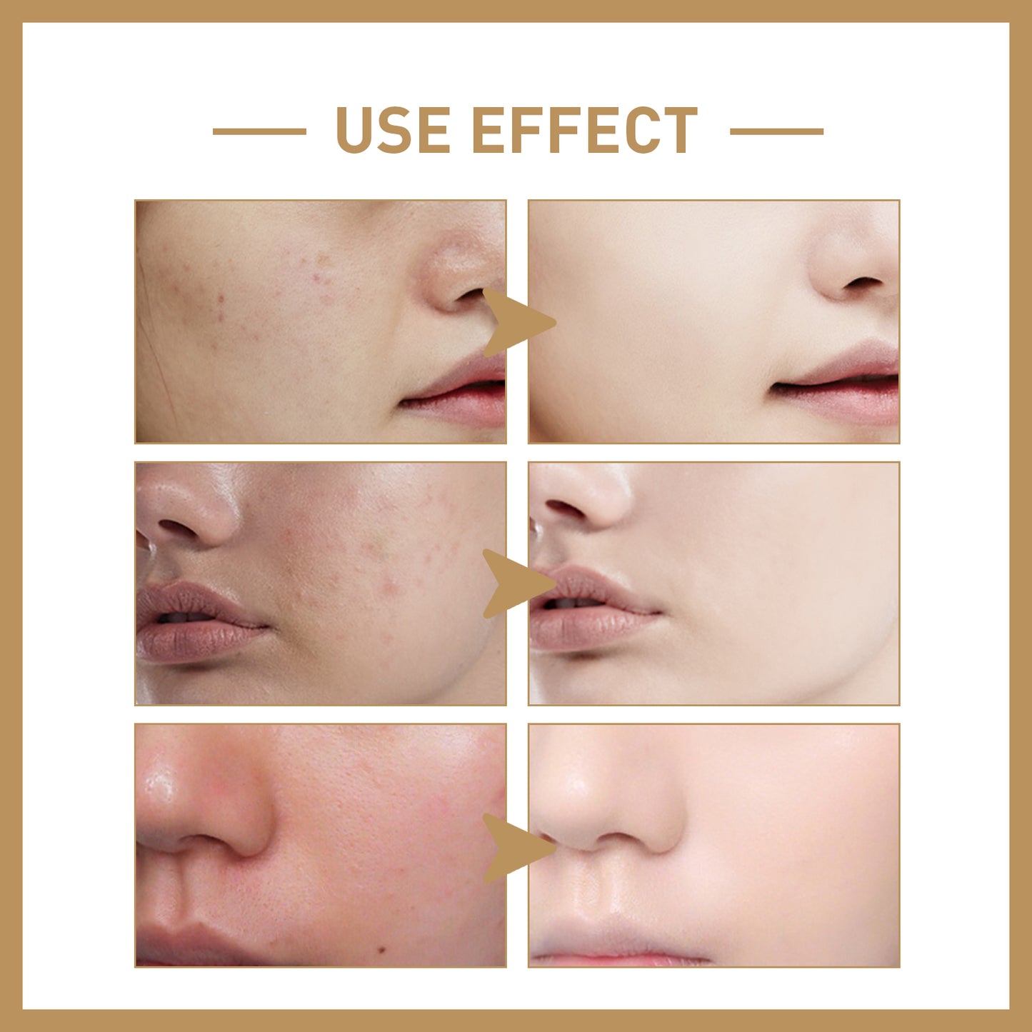 EELHOE Rice Toner for Daily Facial Care - Hydrating, Moisturizing & Brightening Skincare to Balance Oil and Wate