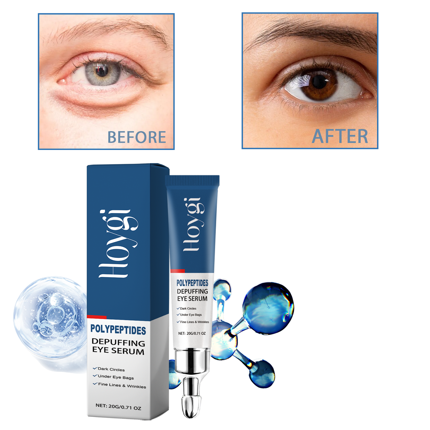 Hoygi Renewing Eye Serum - Dark Circle & Wrinkle Reducing Treatment, Hydrating & Brightening Eye Cream for Puffy Eyes | Peptide-Infused, Moisturizing