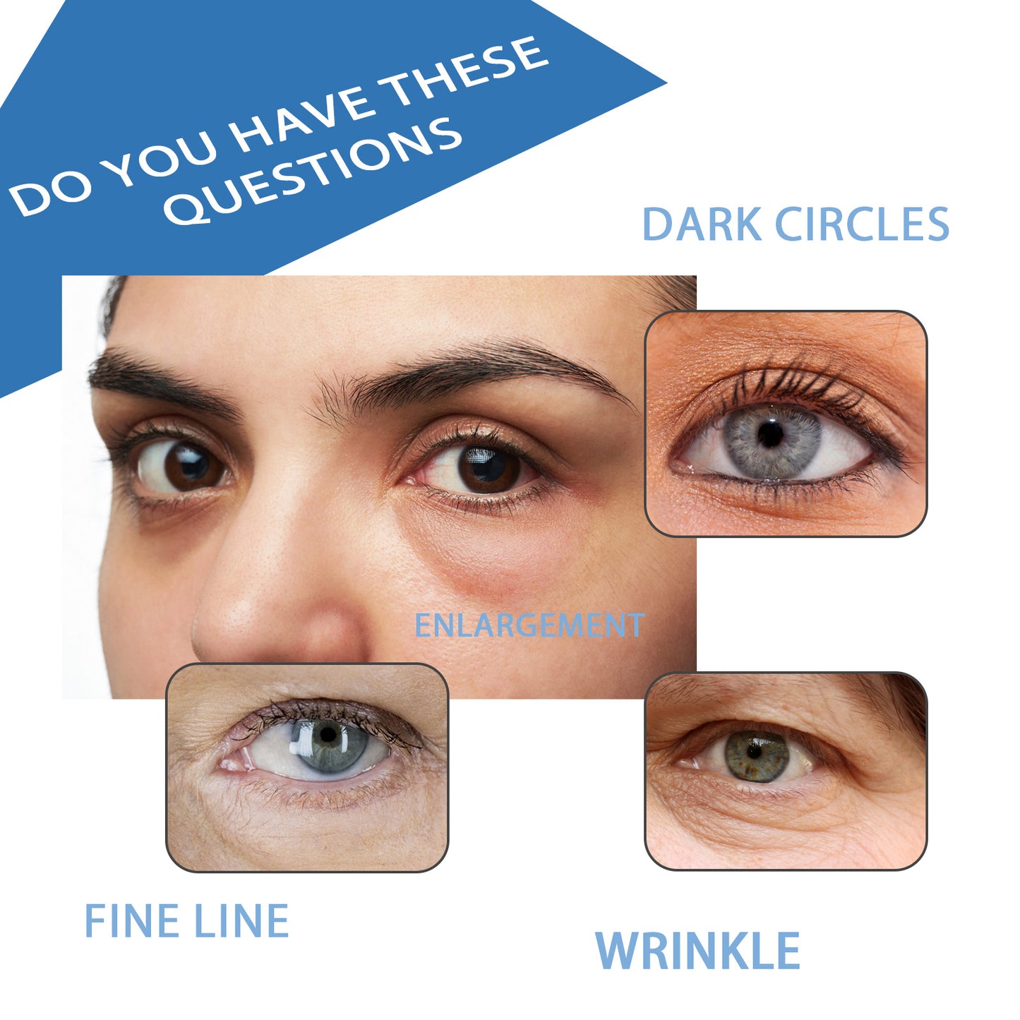 Hoygi Renewing Eye Serum - Dark Circle & Wrinkle Reducing Treatment, Hydrating & Brightening Eye Cream for Puffy Eyes | Peptide-Infused, Moisturizing