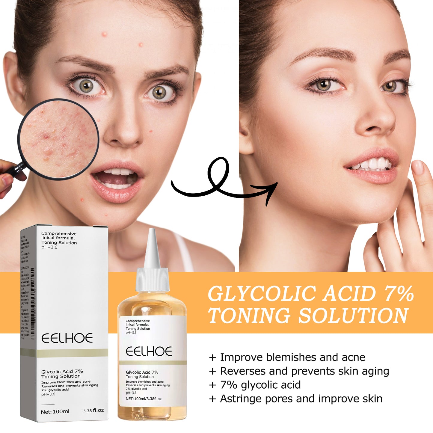 EELHOE 7% Glycolic Acid Toner - Fades Acne Scars, Minimizes Pores, Exfoliates & Brightens Skin