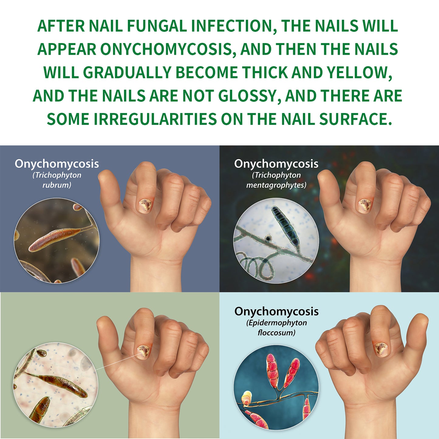 JAYSUING Ginger Nail Care Liquid - with Urea & Glycerin to Support Healthy Nail Growth