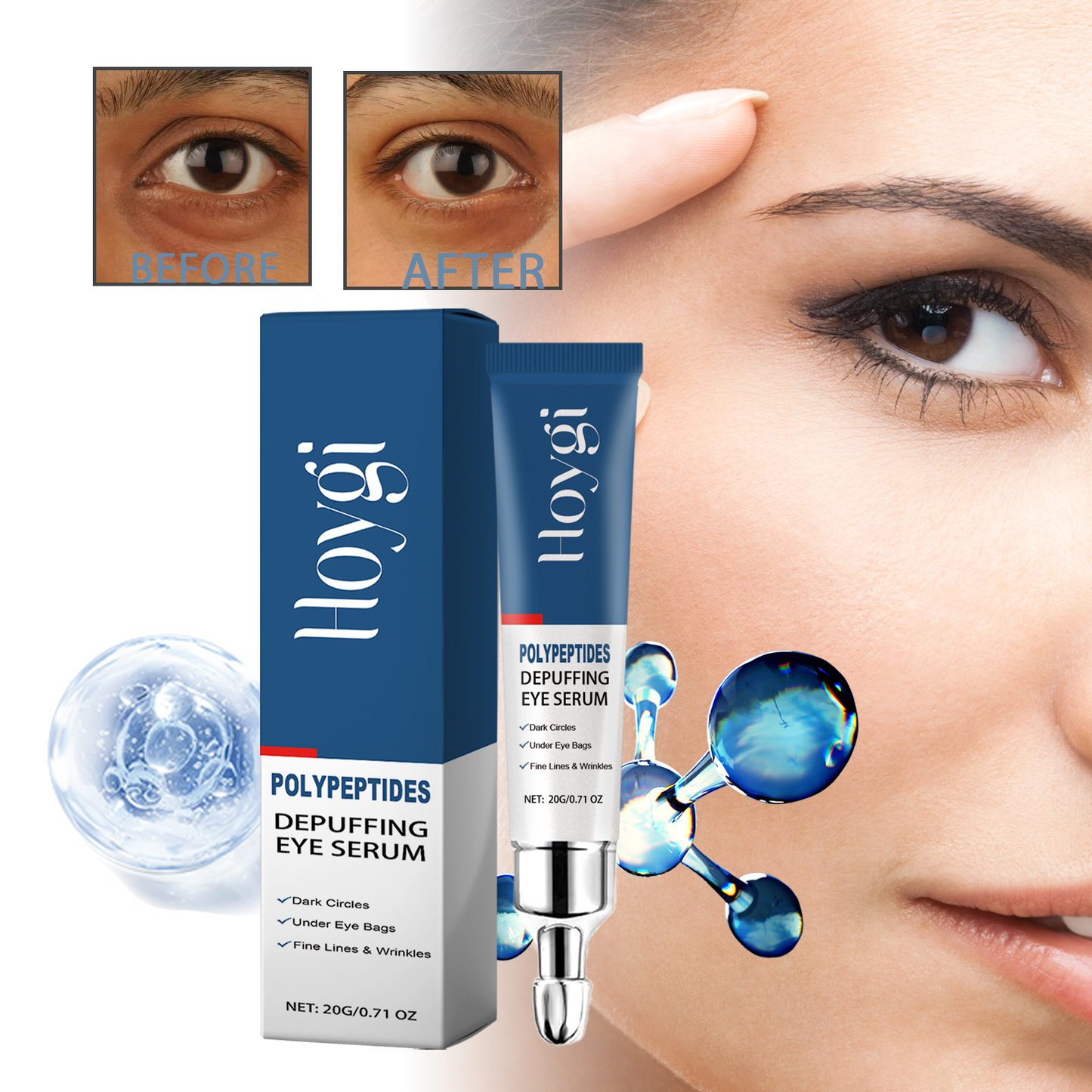 Hoygi Renewing Eye Serum - Dark Circle & Wrinkle Reducing Treatment, Hydrating & Brightening Eye Cream for Puffy Eyes | Peptide-Infused, Moisturizing