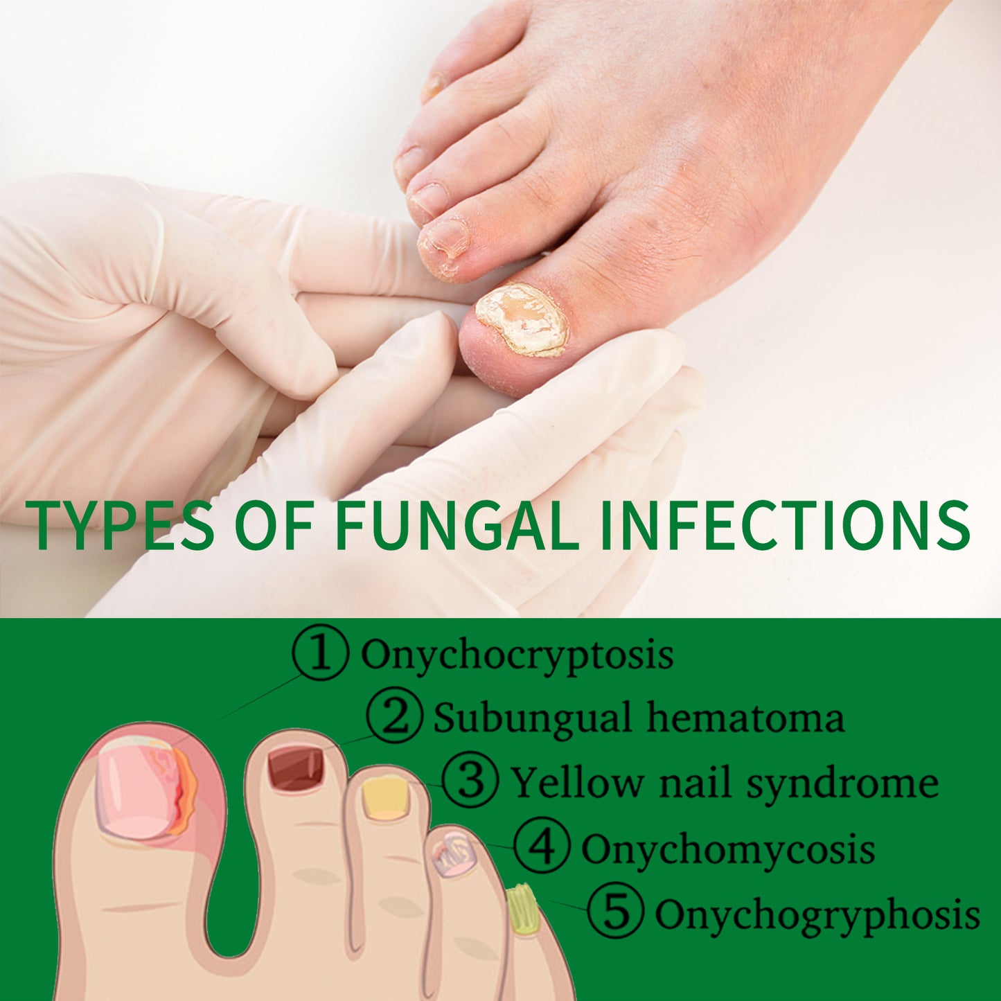 JAYSUING Ginger Nail Care Liquid - with Urea & Glycerin to Support Healthy Nail Growth