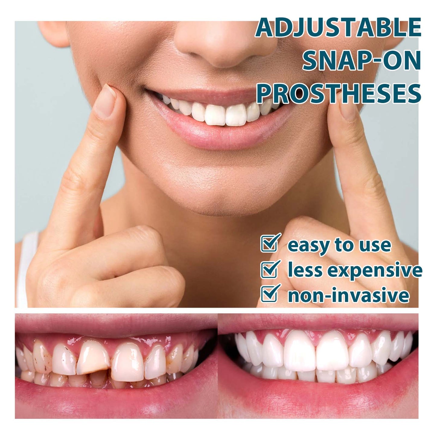 EELHOE Adjustable Snap-On Temporary False Teeth