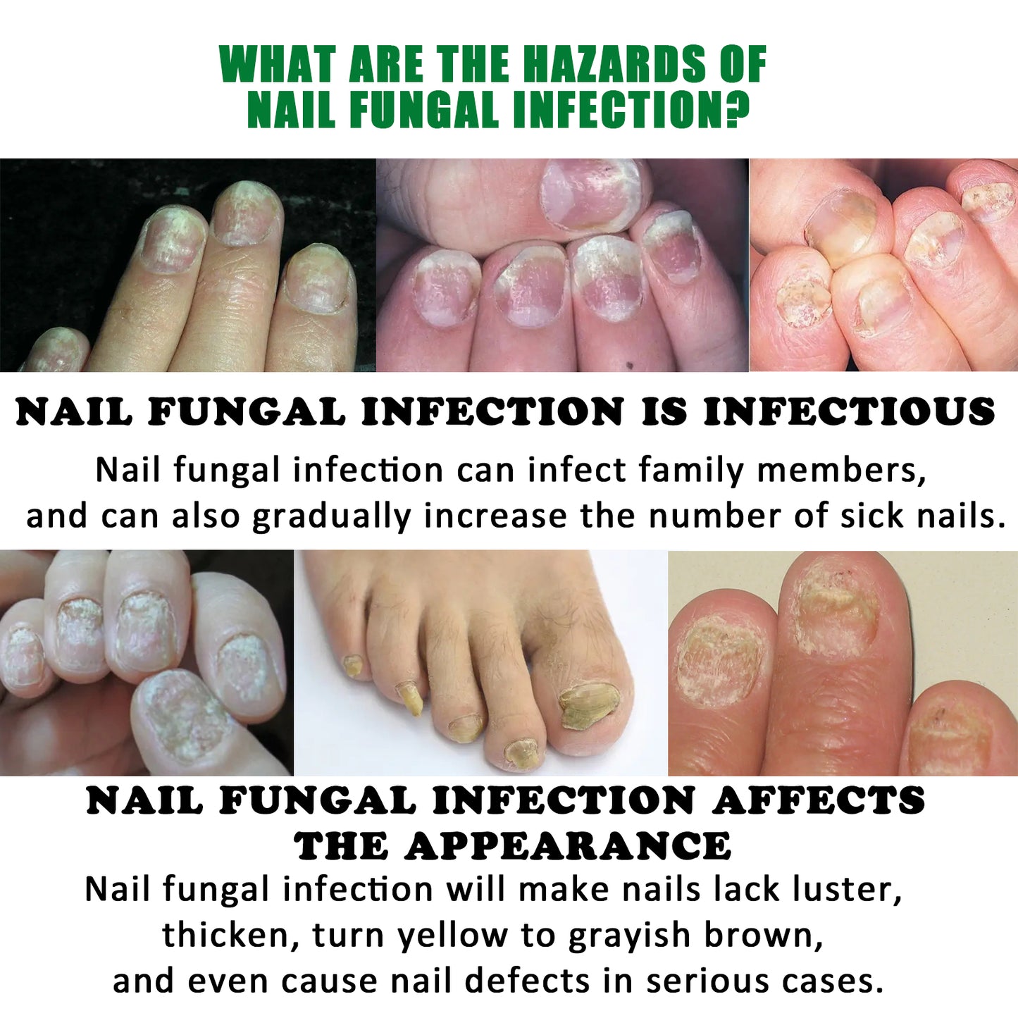Jaysuing Nail & Cuticle Conditioning Serum - with Ginger Extract, Helps Nails Appear Smoother & Stronger, Nourishing Care
