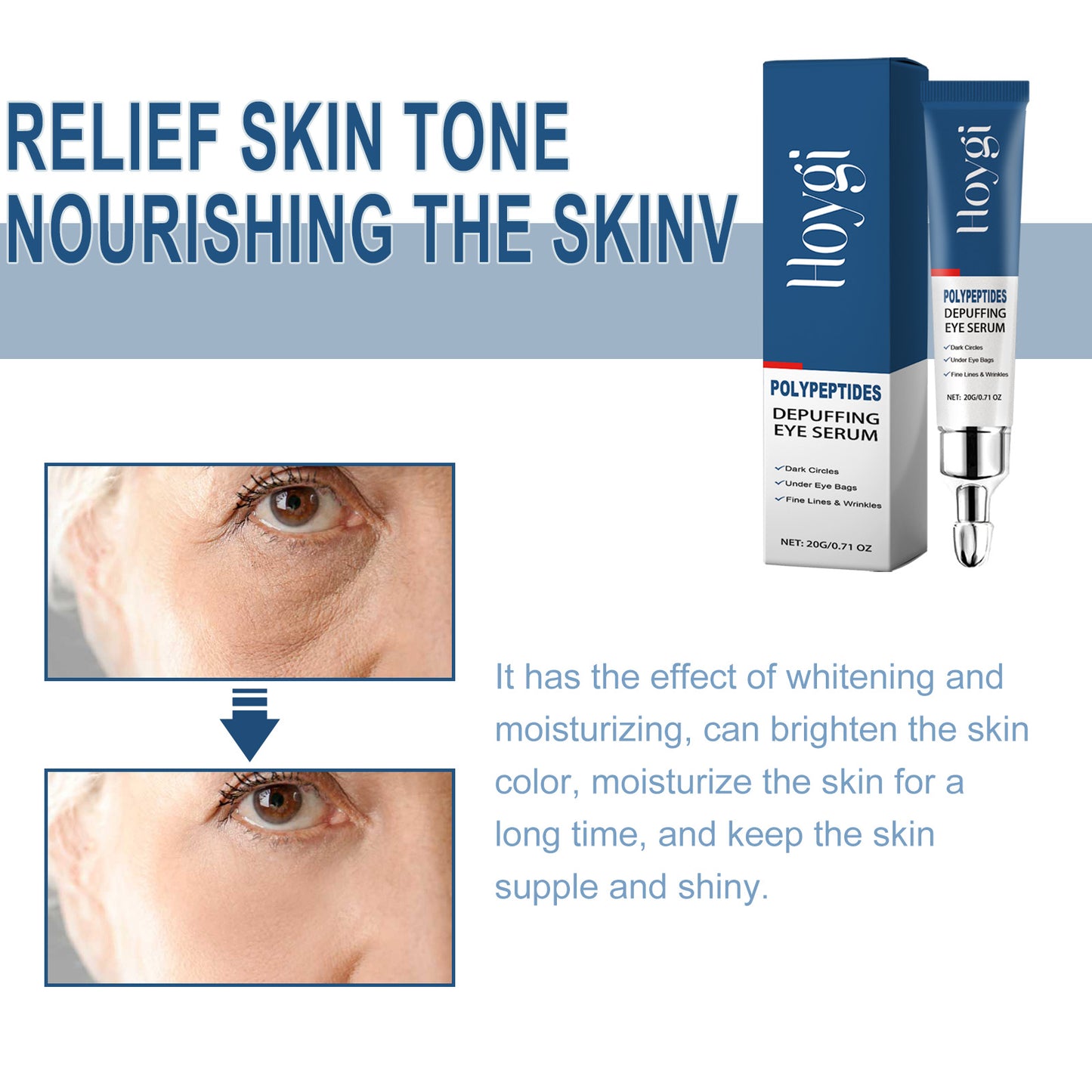 Hoygi Renewing Eye Serum - Dark Circle & Wrinkle Reducing Treatment, Hydrating & Brightening Eye Cream for Puffy Eyes | Peptide-Infused, Moisturizing