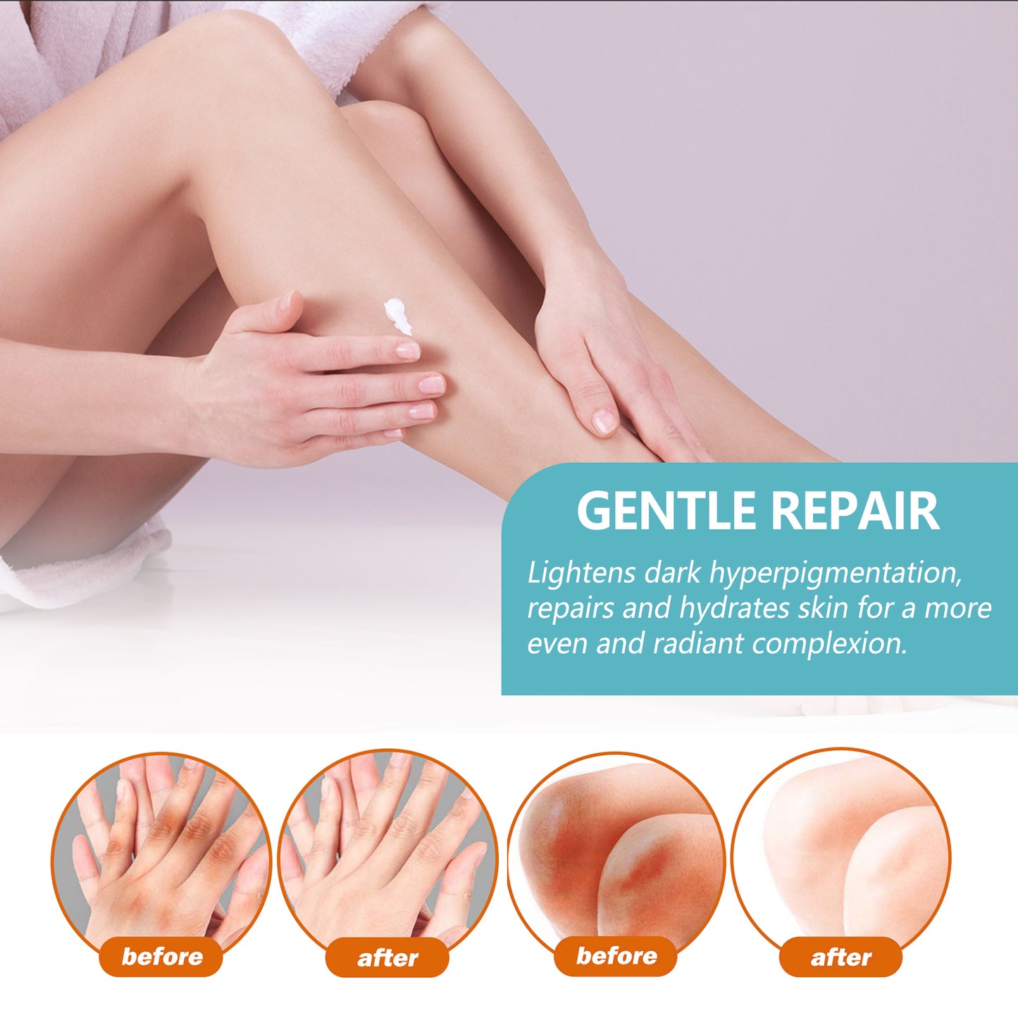 EELHOE Dark Spot Corrector & Brightening Cream - Retinol Body Lotion for Underarms, Knees, Elbows | Exfoliates & Smooths Skin