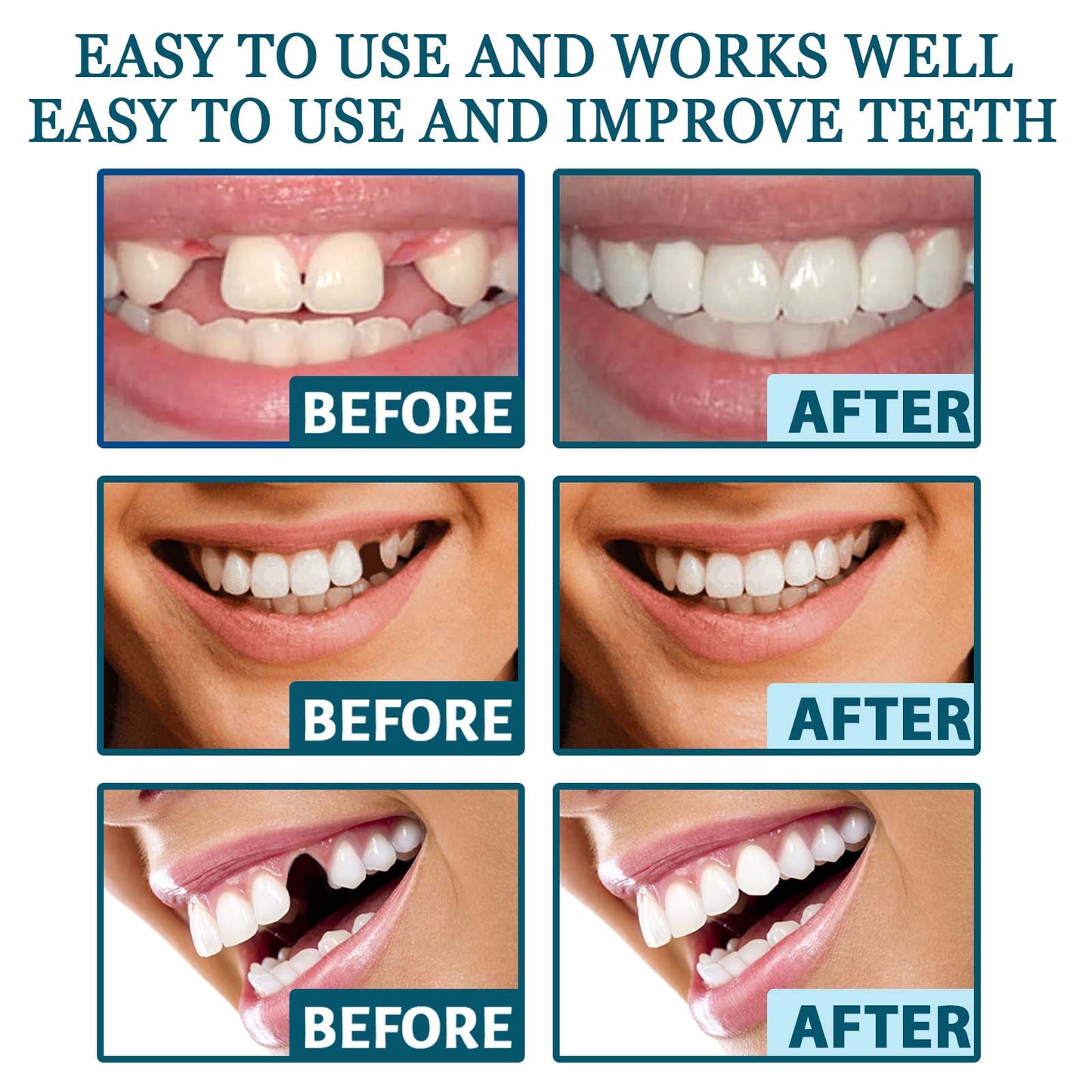 EELHOE Adjustable Snap-On Temporary False Teeth