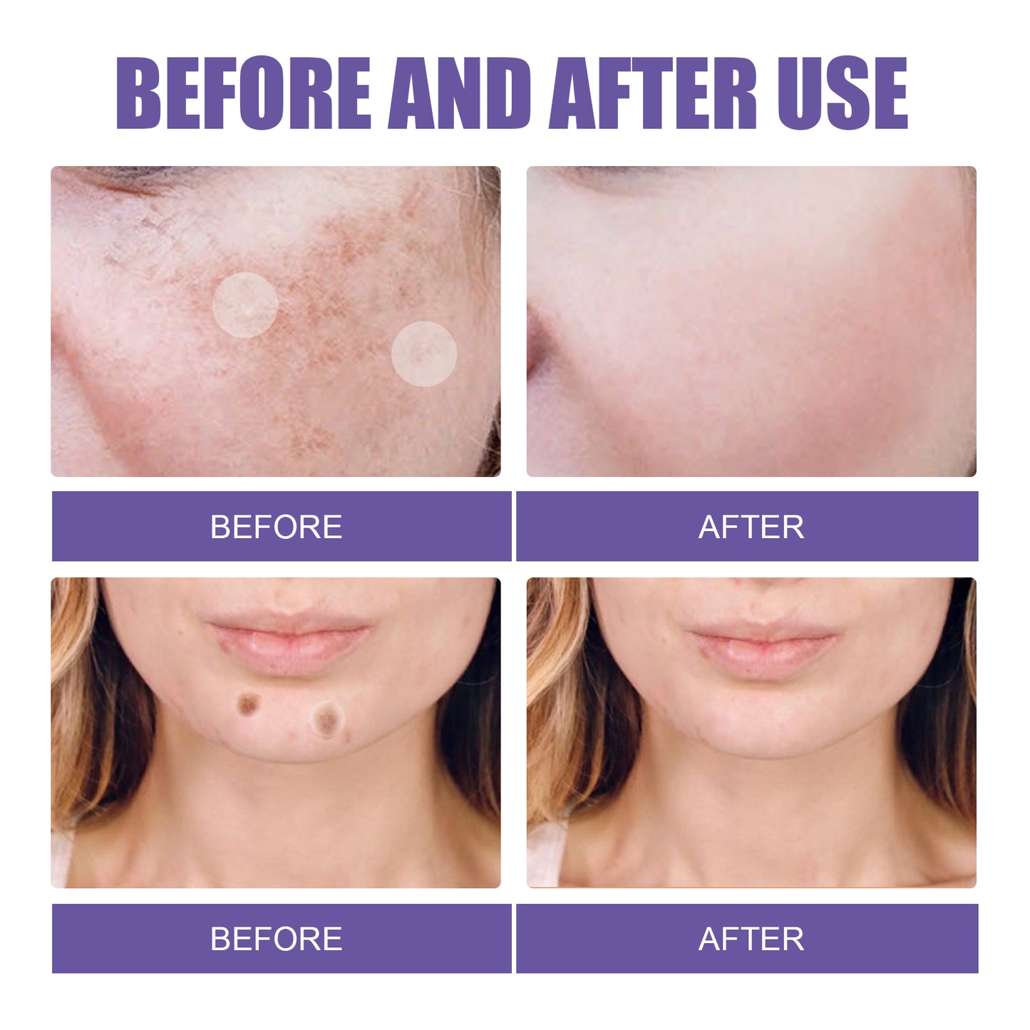 EELHOE Gentle Cleansing Facial Treatment Pads
