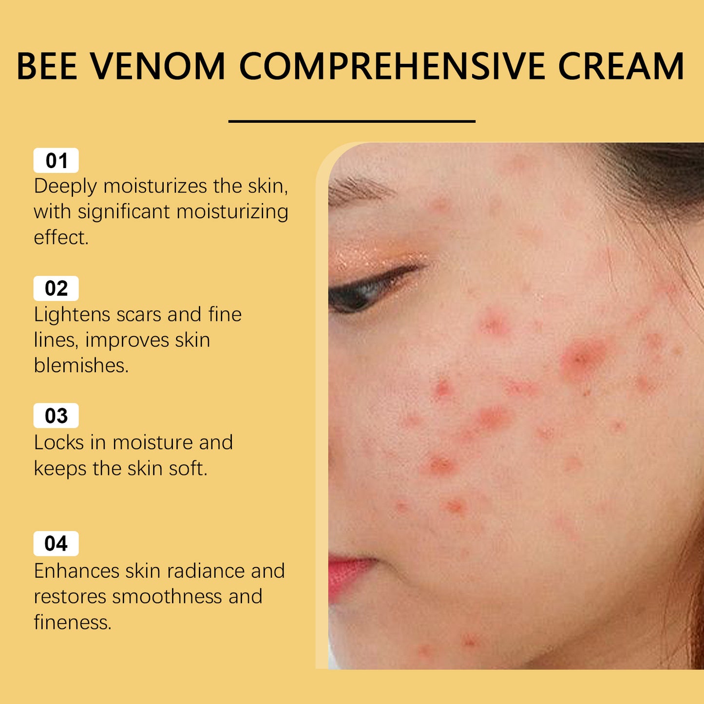 Hoygi Bee Venom & Peptide Collagen Cream - Deeply Hydrating & Firming Daily Moisturizer