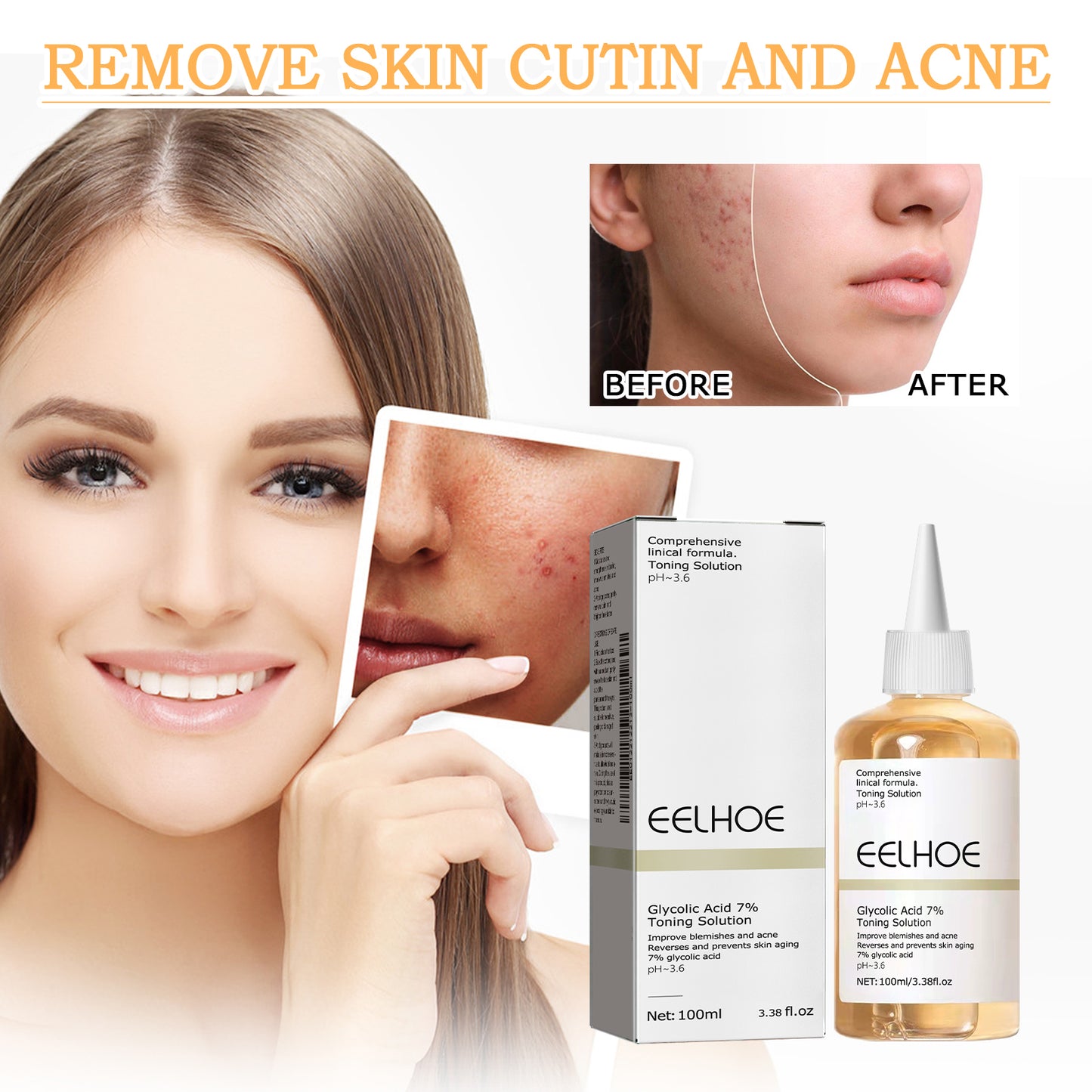 EELHOE 7% Glycolic Acid Toner - Fades Acne Scars, Minimizes Pores, Exfoliates & Brightens Skin