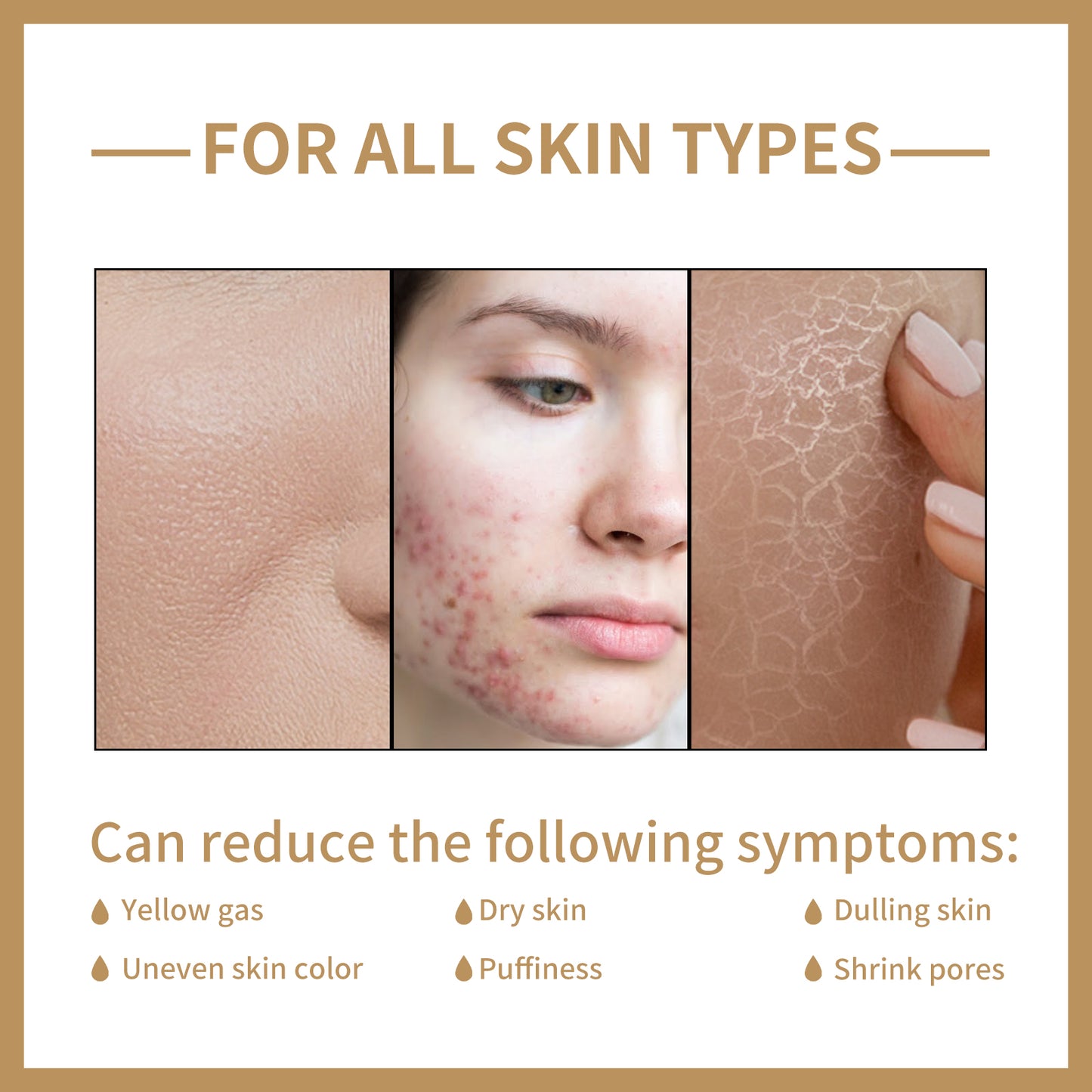 EELHOE Rice Toner for Daily Facial Care - Hydrating, Moisturizing & Brightening Skincare to Balance Oil and Wate