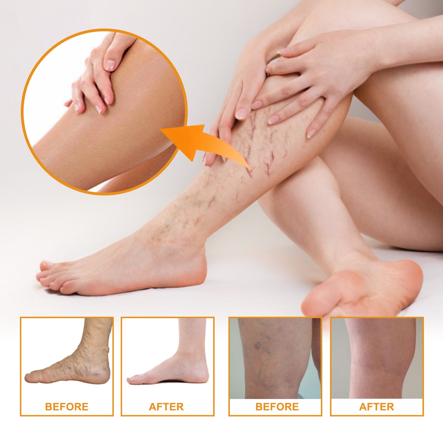 EELHOE Vitamin K Soothing Body Cream