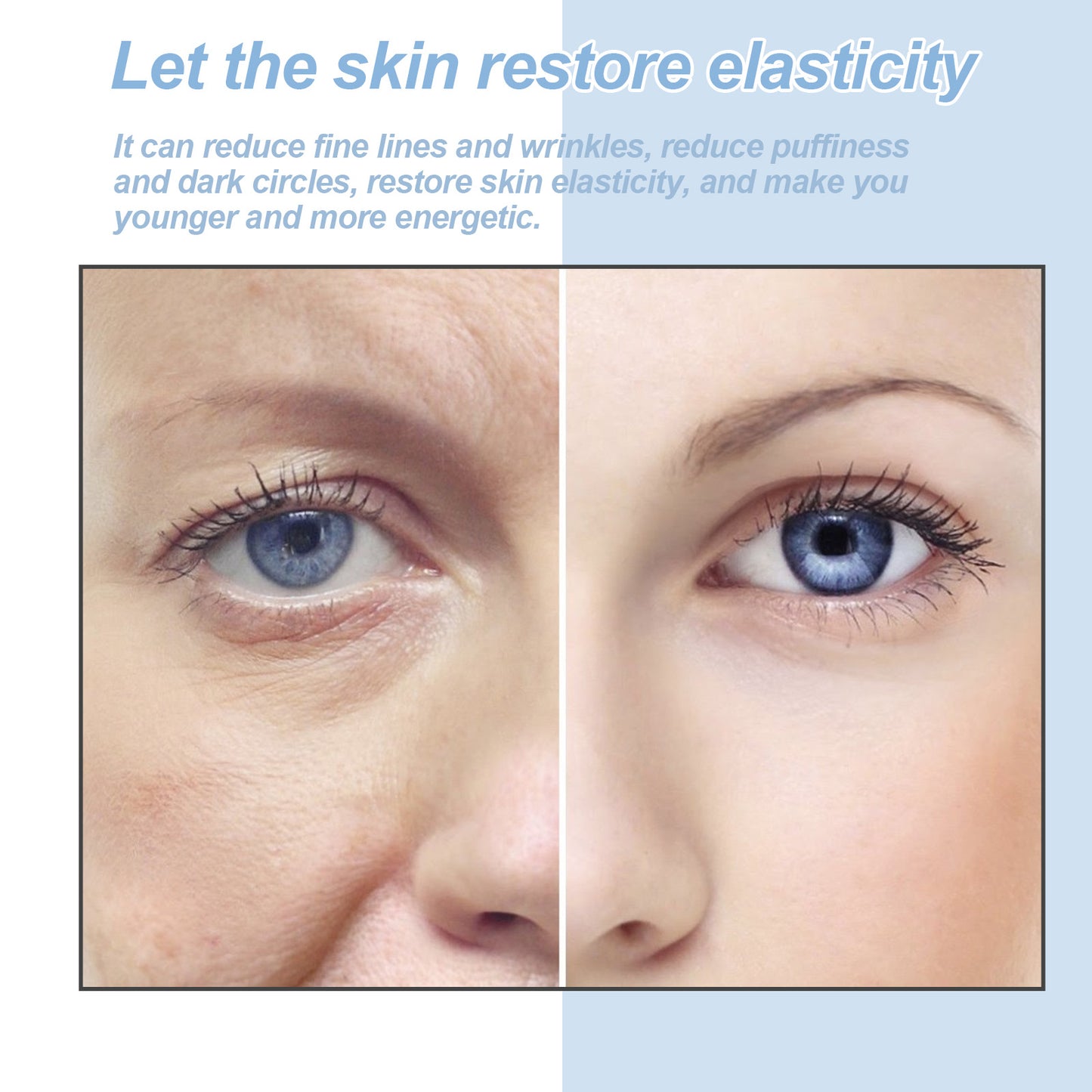 Hoygi Renewing Eye Serum - Dark Circle & Wrinkle Reducing Treatment, Hydrating & Brightening Eye Cream for Puffy Eyes | Peptide-Infused, Moisturizing