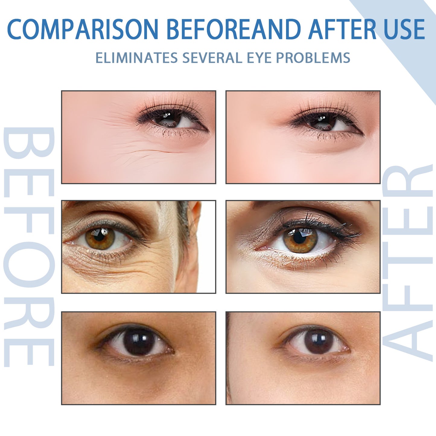 Hoygi Renewing Eye Serum - Dark Circle & Wrinkle Reducing Treatment, Hydrating & Brightening Eye Cream for Puffy Eyes | Peptide-Infused, Moisturizing