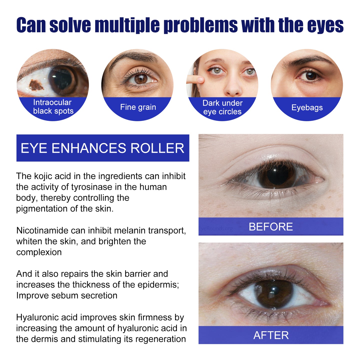 Jaysuing Cooling Eye Contour Roller - Depuffing & Brightening, with Caffeine & Hyaluronic Acid, Massage Tool for Under-Eye Area