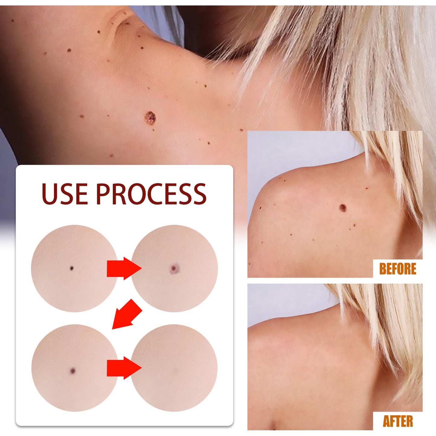 West&Month Targeted Skin Smoothing Liquid - For the Appearance of Rough Skin Bumps, Precise Applicator