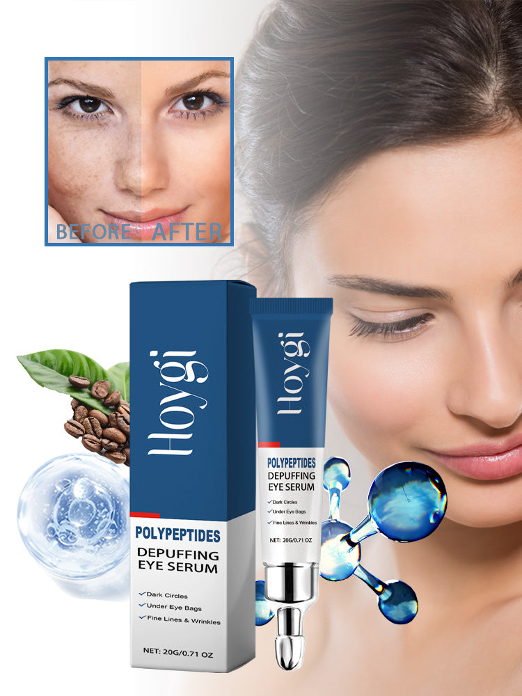 Hoygi Renewing Eye Serum - Dark Circle & Wrinkle Reducing Treatment, Hydrating & Brightening Eye Cream for Puffy Eyes | Peptide-Infused, Moisturizing