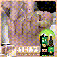 Jaysuing Nail & Cuticle Conditioning Serum - with Ginger Extract, Helps Nails Appear Smoother & Stronger, Nourishing Care