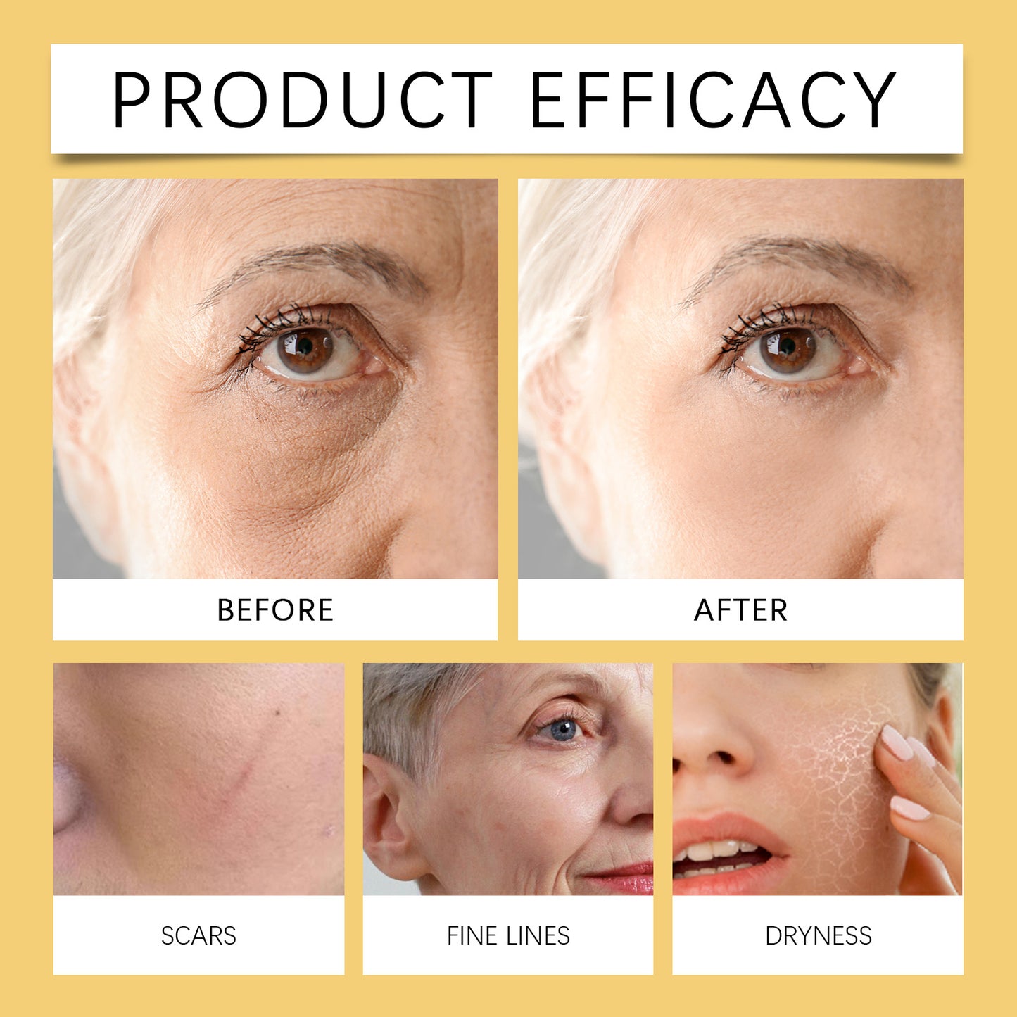 Hoygi Bee Venom & Peptide Collagen Cream - Deeply Hydrating & Firming Daily Moisturizer