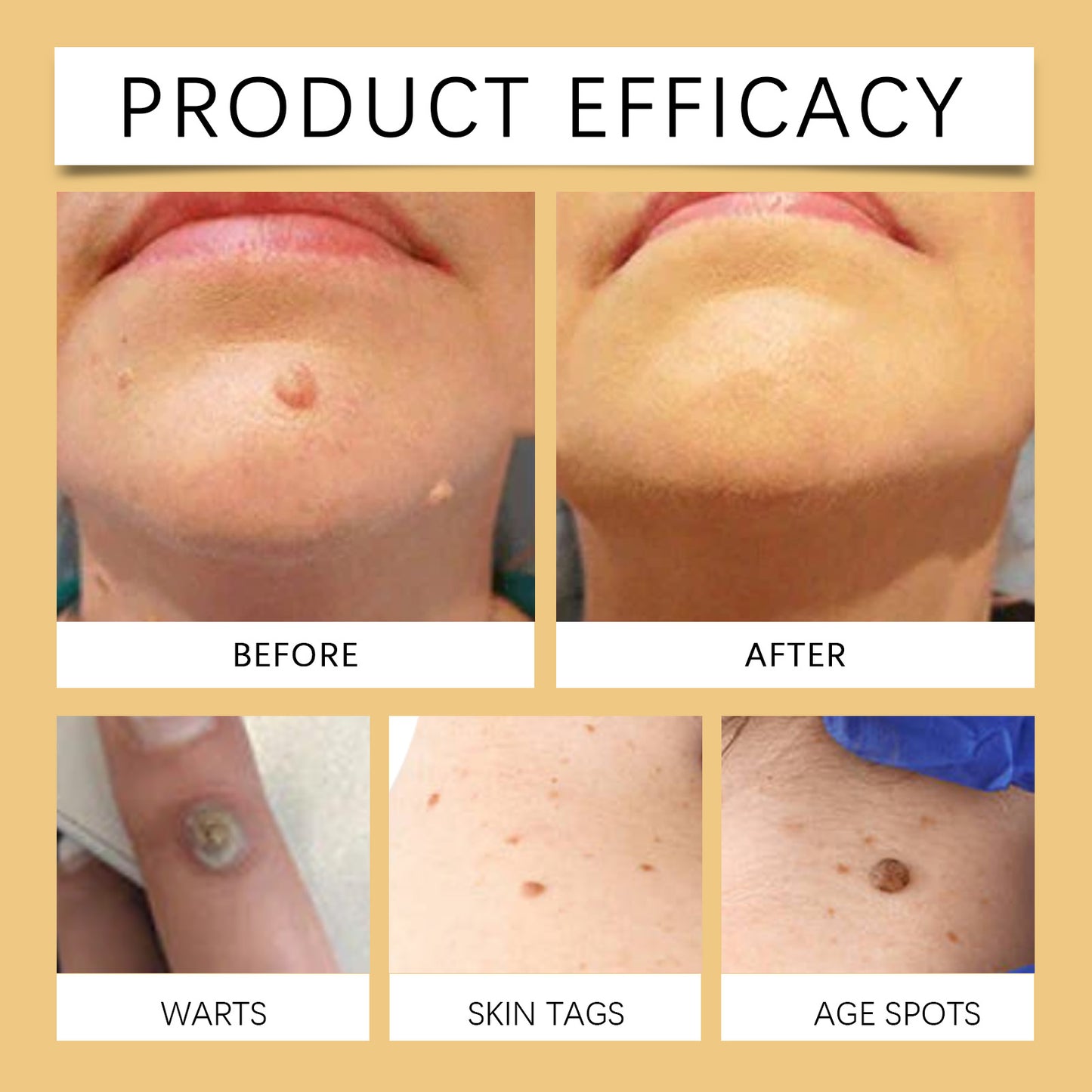 Wiyun Soothing Skin Cream - For Dry & Rough Patches, Propolis-Infused Moisturizer