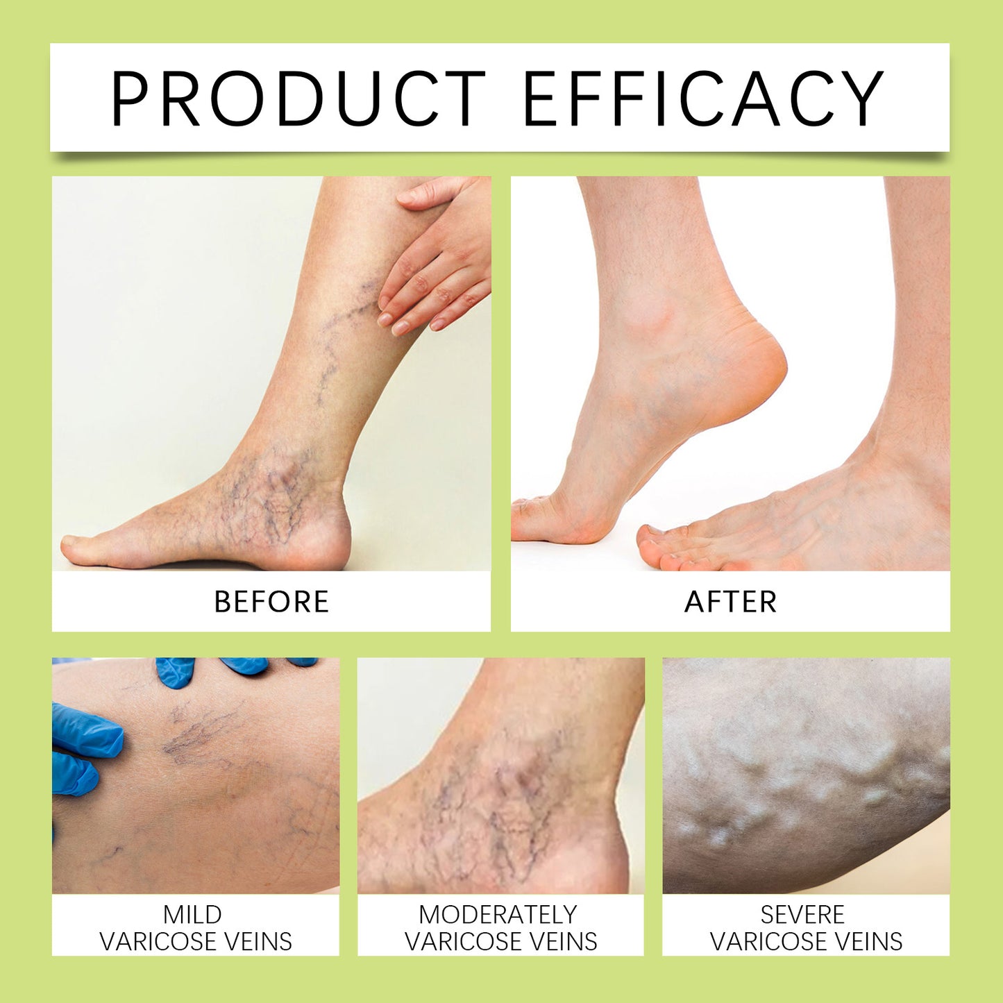 Ximonth Soothing Leg Balm - Calming Cream with Arnica & Calendula for Tired Legs, Moisturizing Relief
