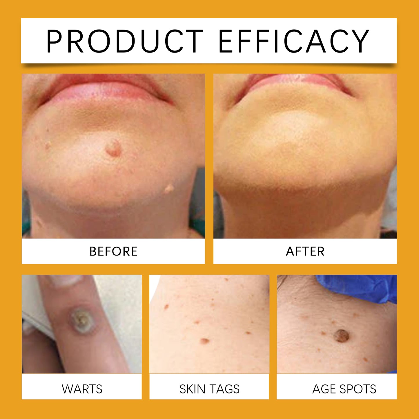WIYUN Smoothing Skin Balm - Propolis & Arnica Formula for Rough Skin Texture, Moisturizing Cream