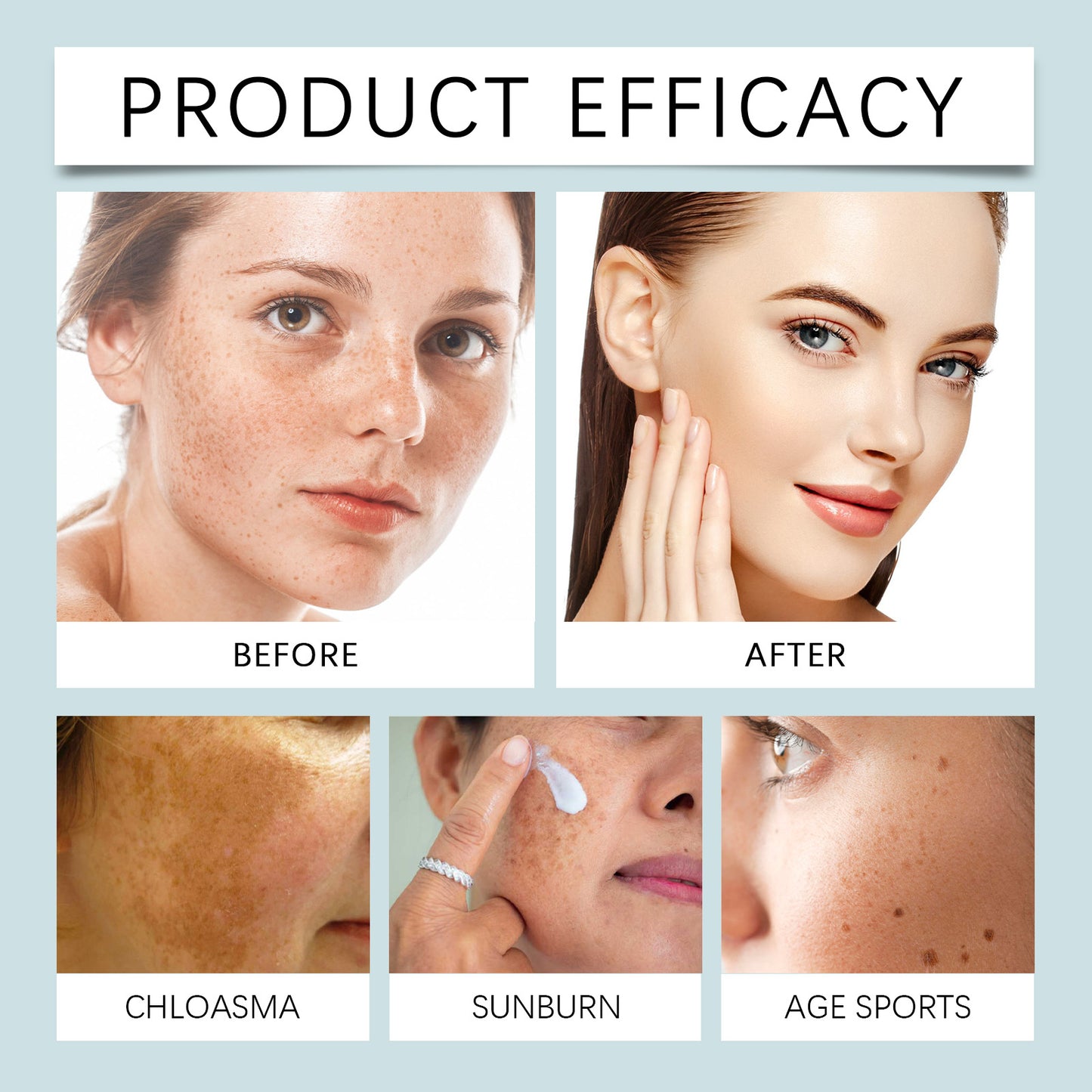 HOYGI Brightening & Dark Spot Serum - with Retinol & Vitamin C to Even Skin Tone, Brighten Complexion