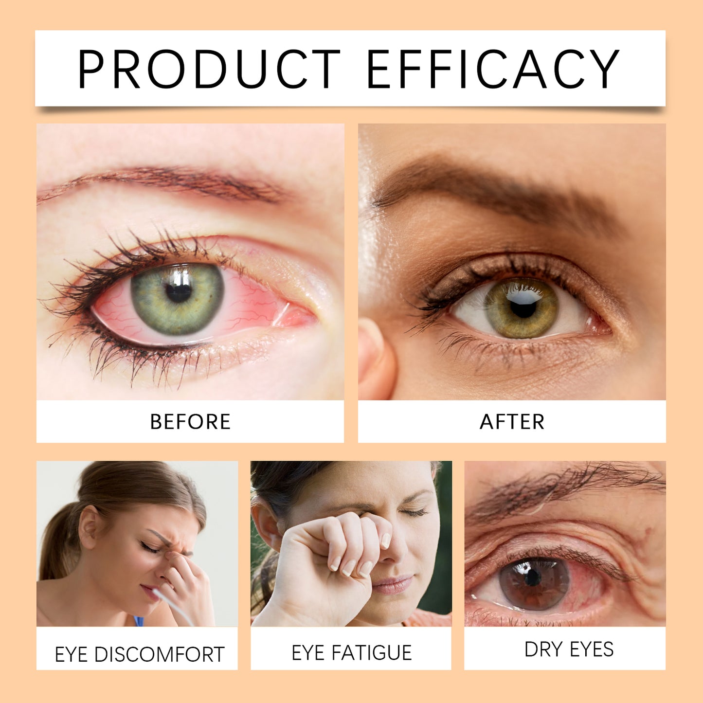Ximonth Soothing Eye Drops - Hydrating Eye Comfort Drops with Honey Extract, for Temporary Dryness Relief