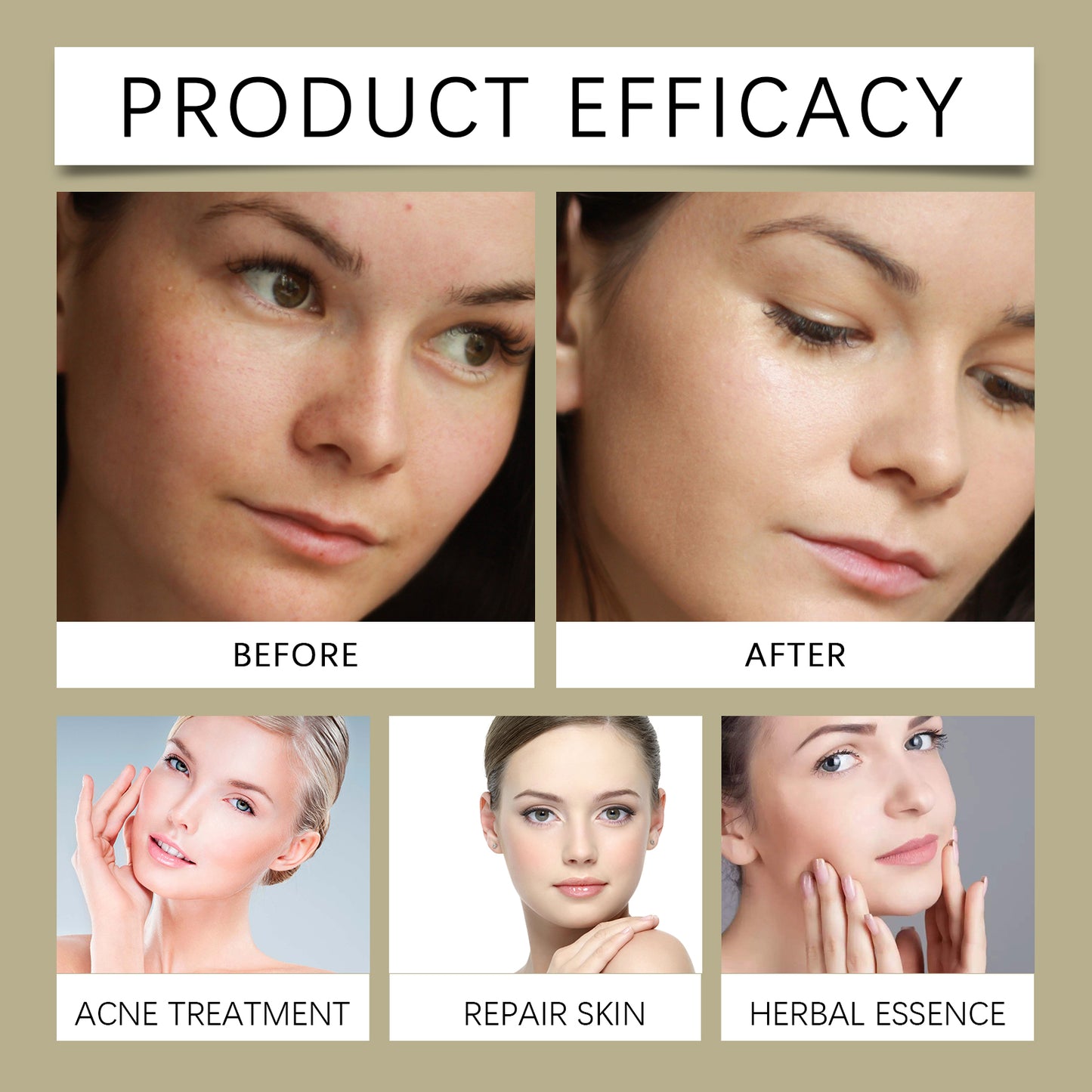 OUHOE Glycolic Acid 7% Exfoliating Toner - Pore Minimizing, Skin Renewal, for Acne and Blackheads