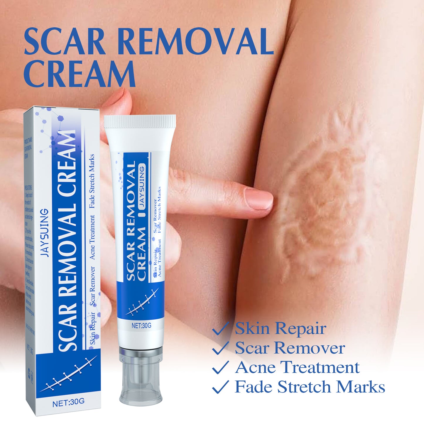 JAYSUING Scar Cream with Aloe Vera Extract - Visibly Reduces Appearance of Scars, Moisturizes & Soothes Skin