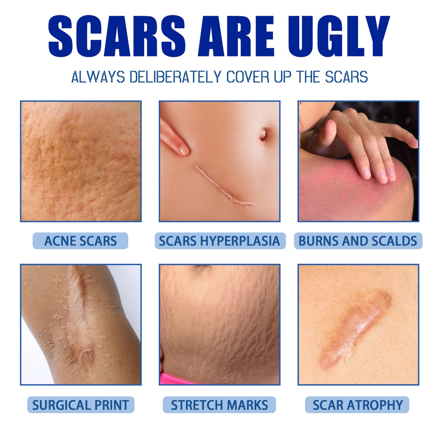 JAYSUING Scar Cream with Aloe Vera Extract - Visibly Reduces Appearance of Scars, Moisturizes & Soothes Skin