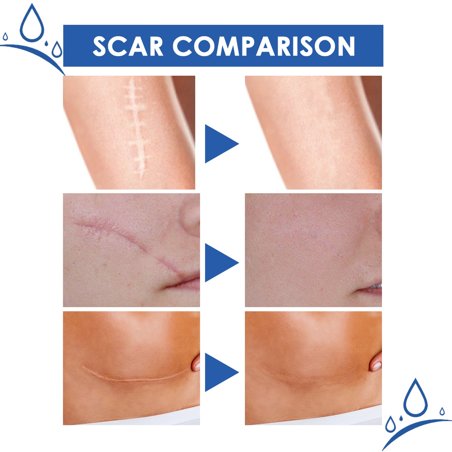 JAYSUING Scar Cream with Aloe Vera Extract - Visibly Reduces Appearance of Scars, Moisturizes & Soothes Skin