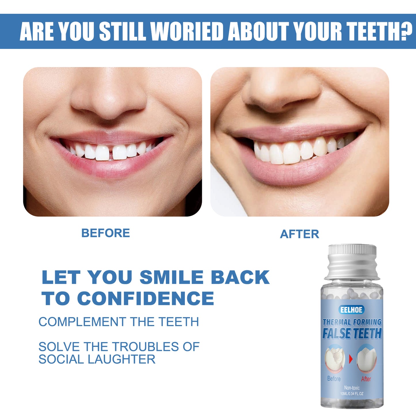 EELHOE Moldable Temporary Dental Filling Gel (30ml)